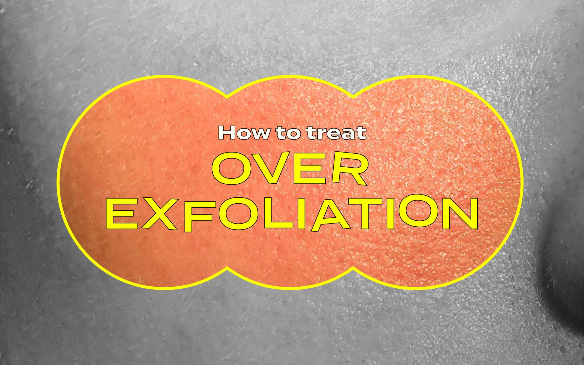 over-exfoliating